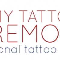 My Tattoo Removal