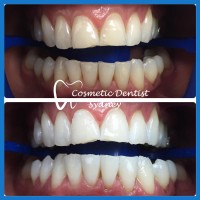 Cosmetic Dentist Sydney