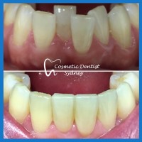 Cosmetic Dentist Sydney