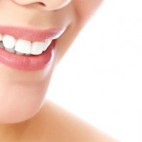 Teeth Whitening Sydney