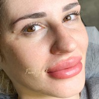 Gallery thumbnail