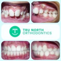 Tru North Orthodontics