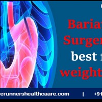 Top Hospitals for Obesity Surgery in India