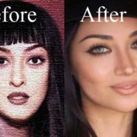 Plastic and Cosmetic surgery Lahore