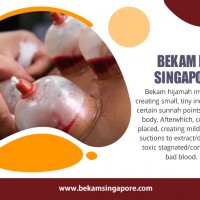 Bekam Singapore