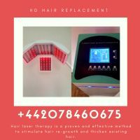 HD Hair Replacement