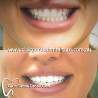 Civic Gentle Dental Care