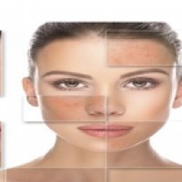 Derm Skin Care Clinic & Face Treatment London