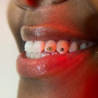 Gallery thumbnail