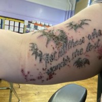 Redink Tattoo Removal