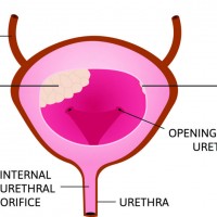 Prostate Ultrasound And Biopsy