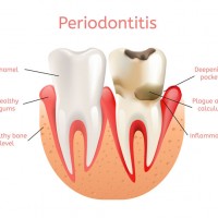 California Dental Group Upland