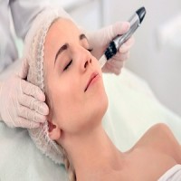 Microneedling Winter Park