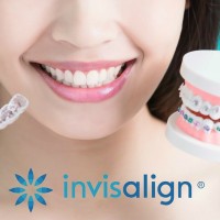 Invisalign Center of Mesa Dental