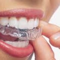 Invisalign Center of Mesa Dental