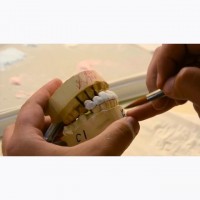 Gallery thumbnail